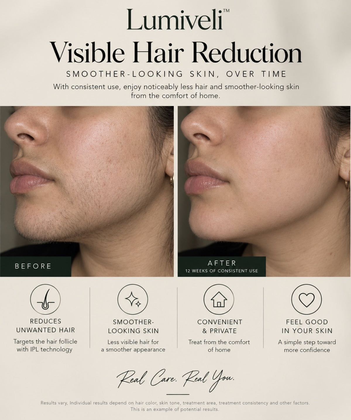 Lumiveli™ IPL Hair Reduction Device